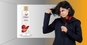 Common Myths About Hair Loss