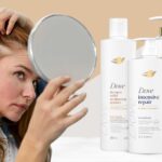 Does Dove shampoo cause hair loss