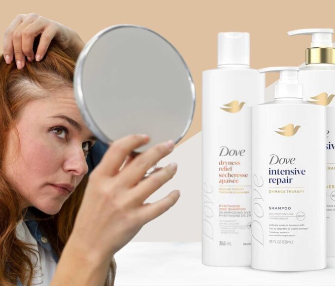 Does Dove shampoo cause hair loss